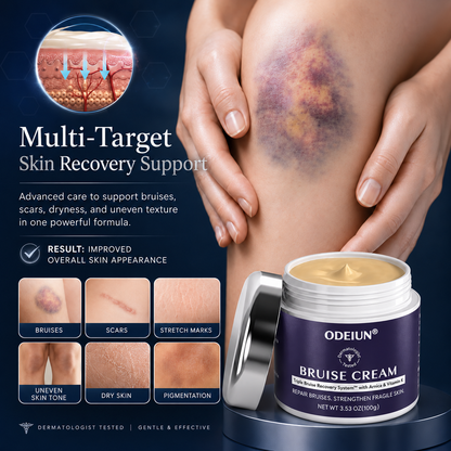 💥100K+ SOLD💕- ODEIUN® Bruise Repair & Skin-Strengthening Cream