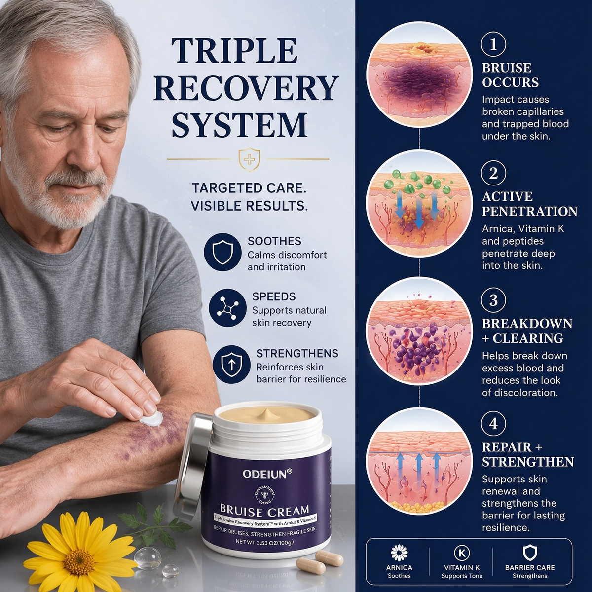 💥100K+ SOLD💕- ODEIUN® Bruise Repair & Skin-Strengthening Cream